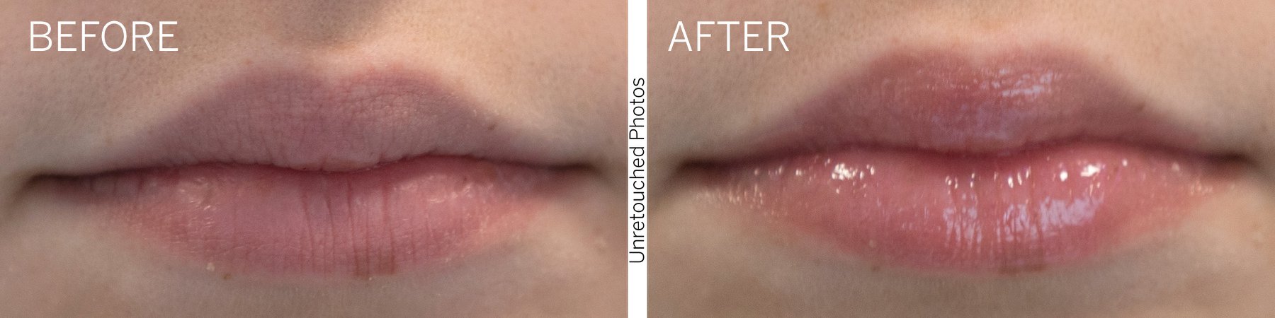 Ignite Lip Plumper